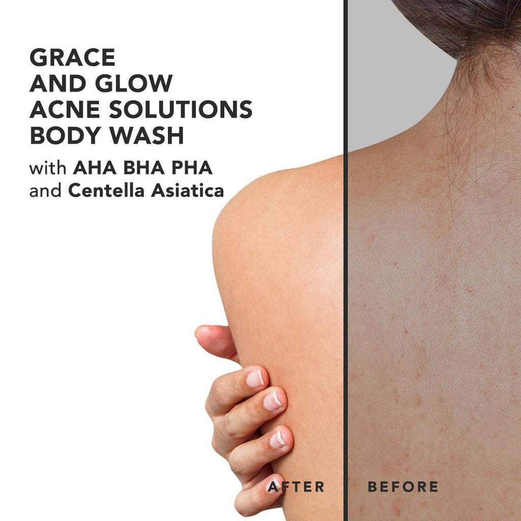 Grace and Glow English Pear and Freesia Anti Acne Body Wash - Glow Mate Exclusive