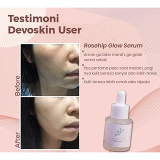 Devoskin Rosehip + Vitamin C Refine Glow Serum - Glow Mates Exclusive