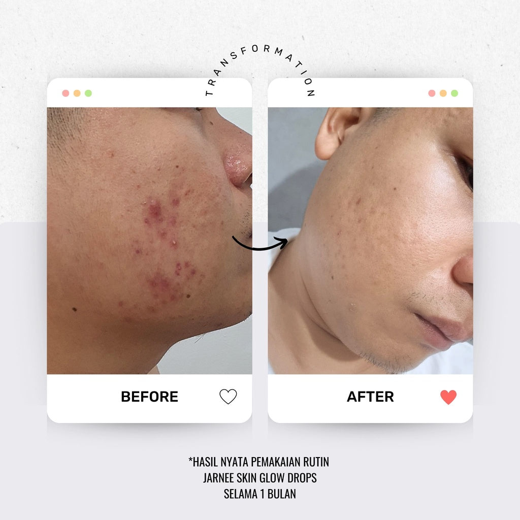 Jarnee Skin Glow Drops Serum - Glow Mates Exclusive