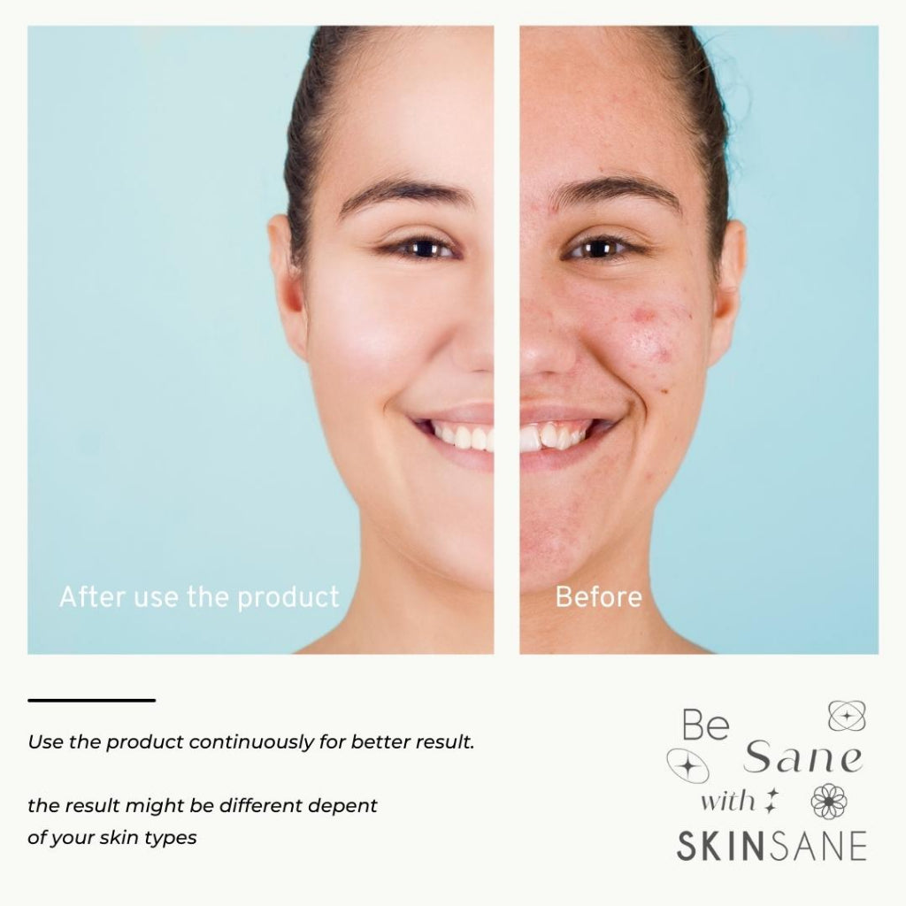 Skinsane Face & Body Bar Soap - Glow Mates Exclusive