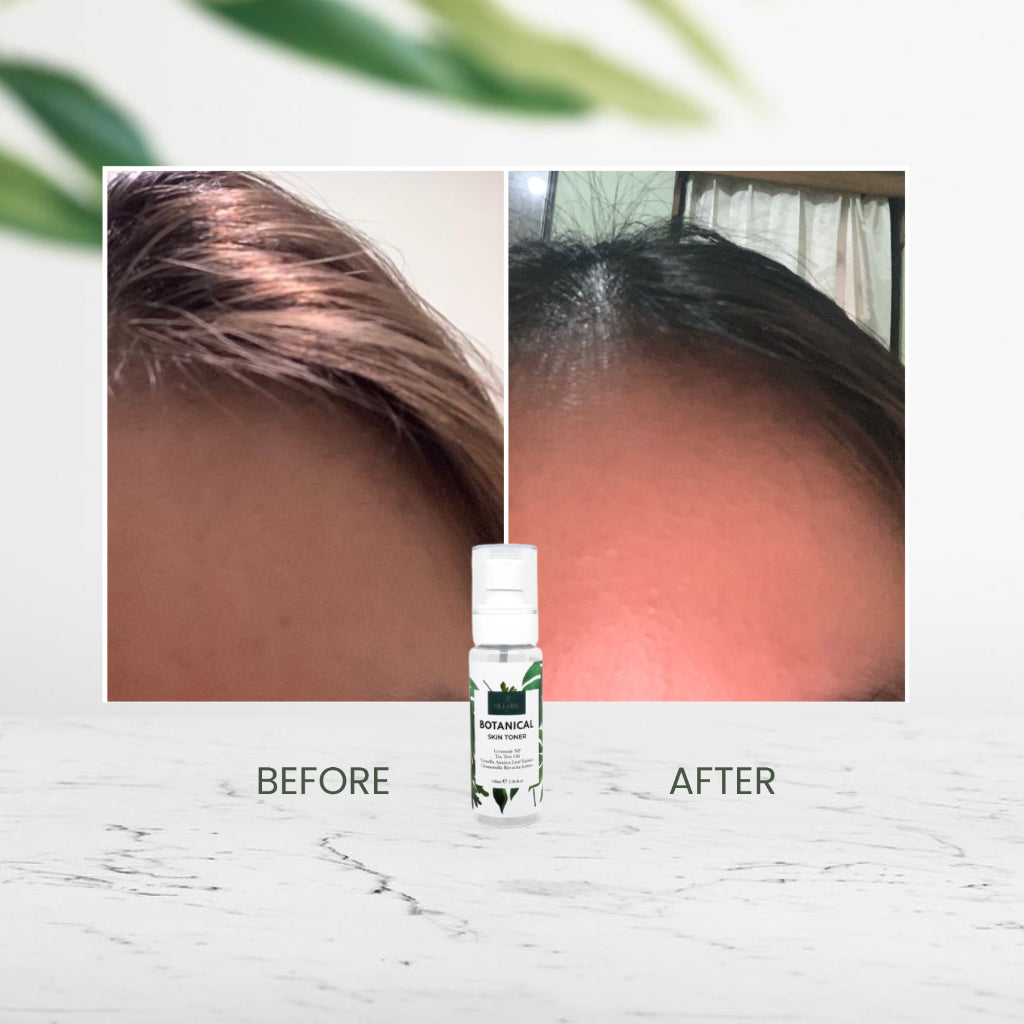 Millgirl Skin Botanical Skin Toner - Glow Mates Exclusive