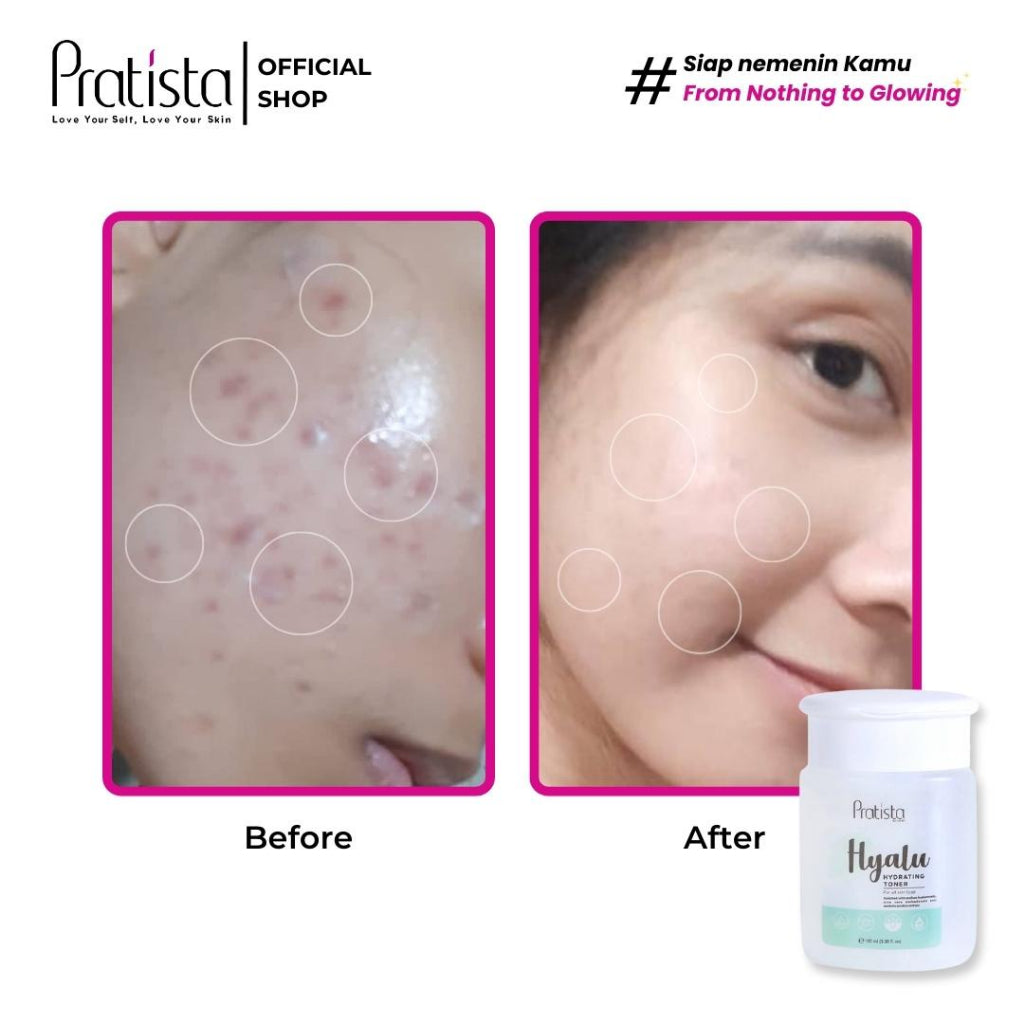 Pratista Hyalu Hydrating Toner - Glow Mates Exclusive