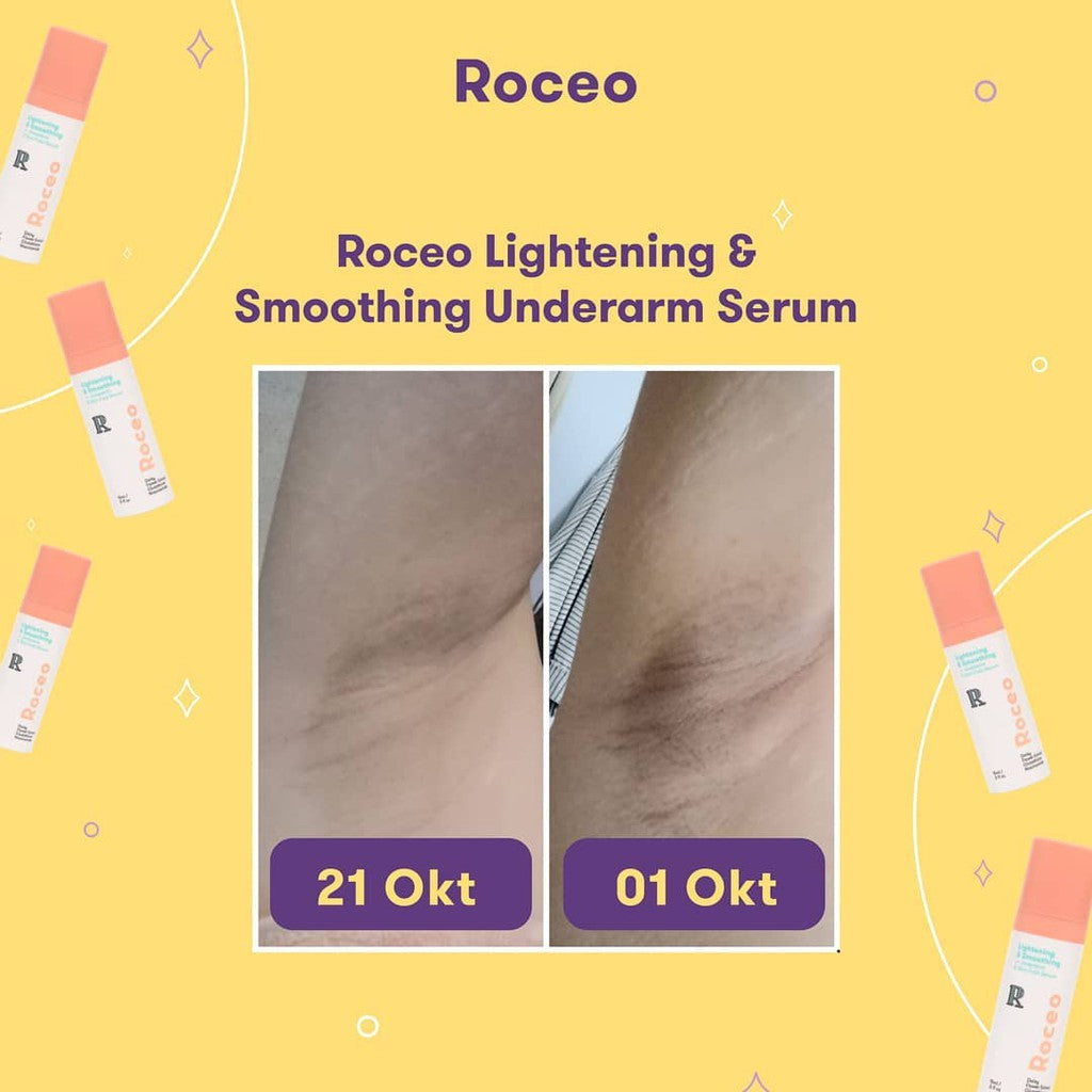 Roceo Lightening and Smoothing Underarm & Skin Fold Serum Glow Mates Exlusive-