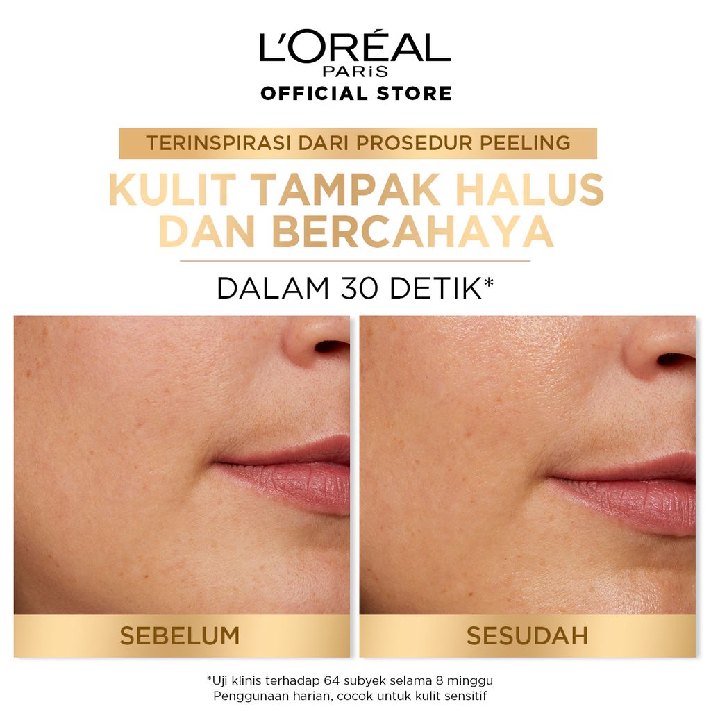 L’Oréal Paris Glycolic Bright Peeling Toner Glow Mates Exclusive-