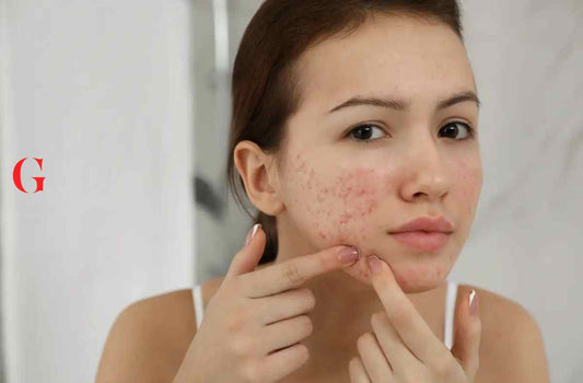 7 Ciri-Ciri Skincare Tidak Cocok di Kulit, Ketahui Sekarang!