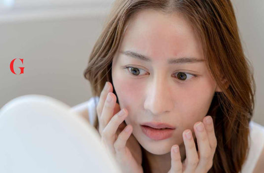 Kenapa Wajah Gatal Saat Memakai Skincare?