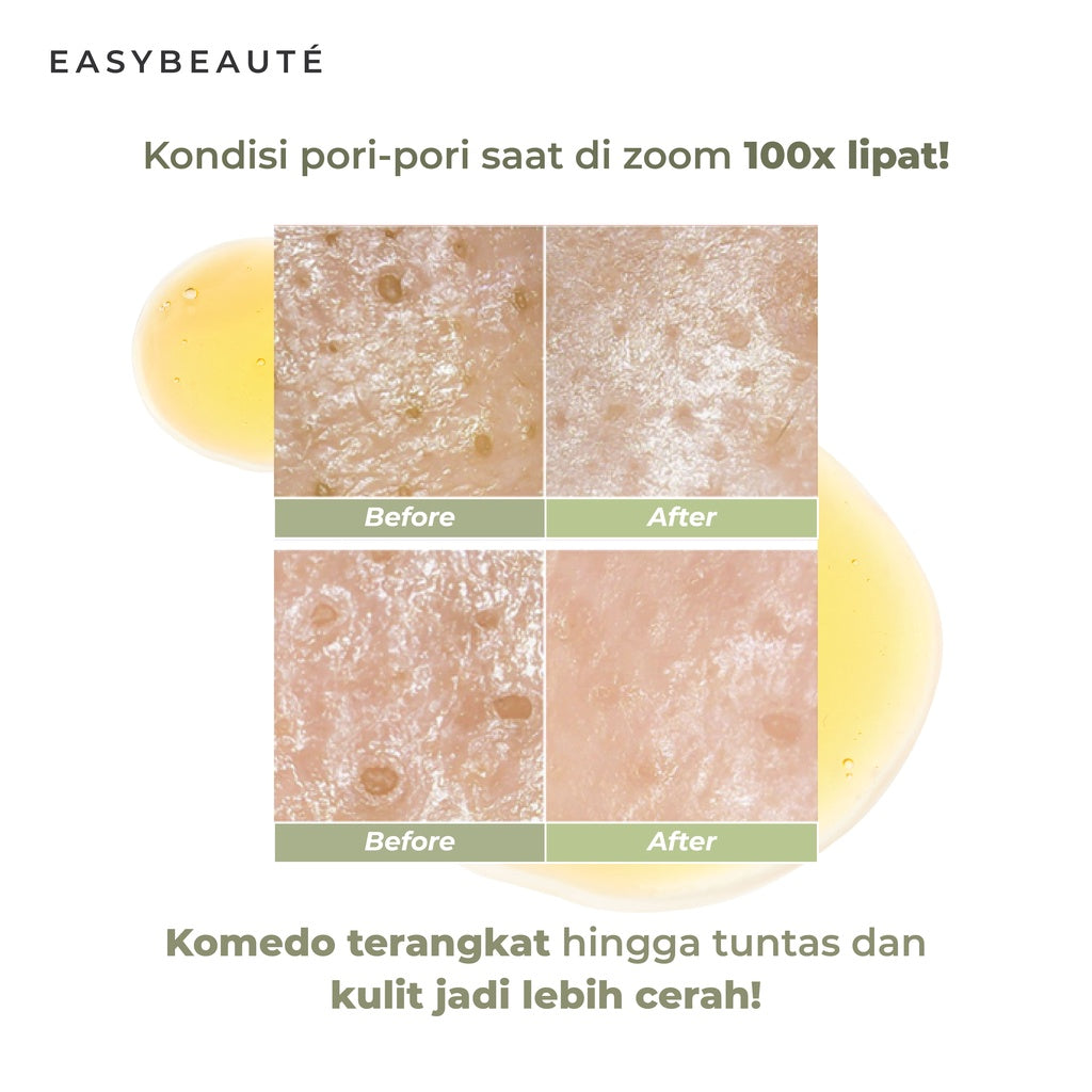 Easybeaute 2 Sheetmask Korean Kalapack - Glow Mates Exclusive