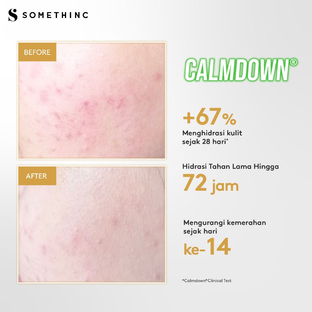 SOMETHINC Calm Down! Skinpair R-Cover Cream Moisturizer